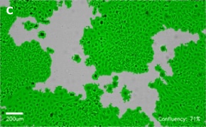 millicell-cell-lines-93021013-c Brightfield imaging of HeLa cells on Millicell<sup>®</sup> DCI Digital Cell Imager at 10X magnification with mask