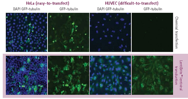 Plasmid vs. lentivirus transfection in easy- and difficult-to-transfect cell types.