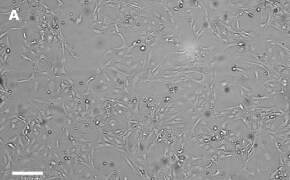 LX-2 Cas9 cells imaged on Millicell<sup>®</sup> DCI Digital Cell Imager Brightfield imaging of LX-2 Cas9 cells on Millicell<sup>®</sup> DCI Digital Cell Imager at 10X magnification