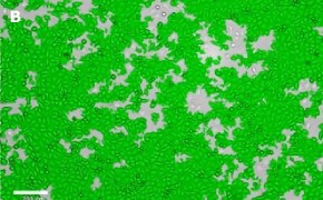 Masked T24T cells on Millicell<sup>®</sup> DCI Digital Cell Imager Brightfield imaging of T24T cells on Millicell<sup>®</sup> DCI Digital Cell Imager at 10X magnification with mask