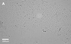 Caco-2 cells imaged on Millicell<sup>®</sup> DCI Digital Cell Imager, 10X Brightfield imaging of Caco-2 cells on Millicell<sup>®</sup> DCI Digital Cell Imager at 10X magnification