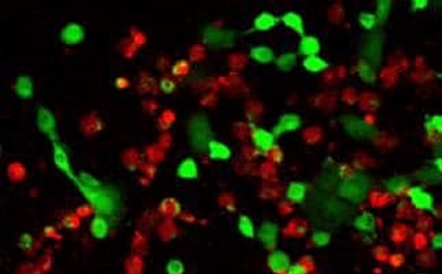 Cell double staining