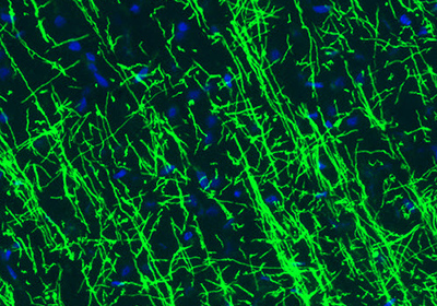 Immunofluorescence staining of rat hippocampus shows strong positivity of the astrocytes.