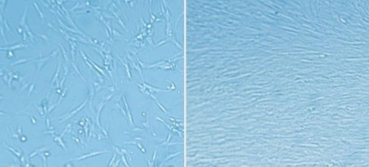 ECM matrix coating enables rapid expansion of fetal lung fibroblasts