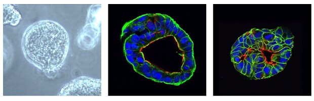Immunocytochemical characterization of human pancreatic organoids Microscopy images of PDAC organoids. The first image is a contrast microscopy image of the organoid, with one large clear organoid in the center of a grey background. The second image is an immunocytochemical stain of the organoid. CK19 surrounds the cells in the organoid and is shown in green, actin lines the inner ring of the cells of the organoid and is shown in red, and DAPI forms small circles in the middle of the cells and is shown in blue. The third image is an immunocytochemical stain of the organoid; EpCAM lines each cell in the organoid and is shown in green, actin lines the inner ring of the cells of the organoid and is shown in red, and DAPI forms small circles in the middle of the cells and is shown in blue.