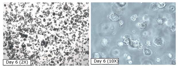 Morphology of PDAC organoids before cryopreservation Microscopy images of PDAC organoids before cryopreservation. The first image shows organoids at Day 6 at 2X magnification, with small black circles covering the entirety of the image. The second image shows organoids at Day 6 at 10X magnification, with larger clear circles on a grey background.