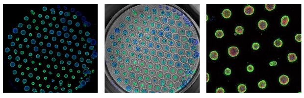 PDAC organoids cultured in Millicell® Microwell plates Microscopy images of PDAC organoids cultured in Millicell® Microwell plates and stained with EpCAM in green, which surrounds each organoid, action in red, which is in the center of each organoid, and DAPI in blue, which is in the center of each organoid. In the first image, multiple small blue and green circles are in a hexagon grid in the center of a black background. In the second image, multiple small blue and green circles are in a hexagon grid and within slightly larger grey circles, indicating the microwell grid. In the third image, slightly larger green and red circles are spaced evenly on a black background.