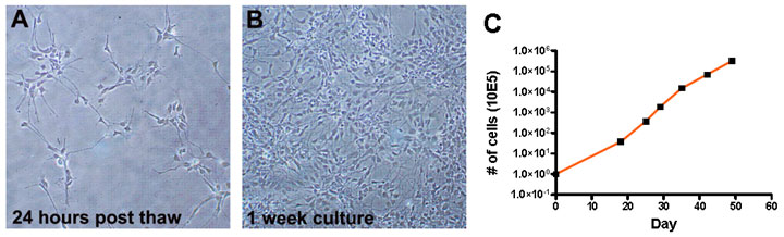 Bright field images of proliferating Human OPCs