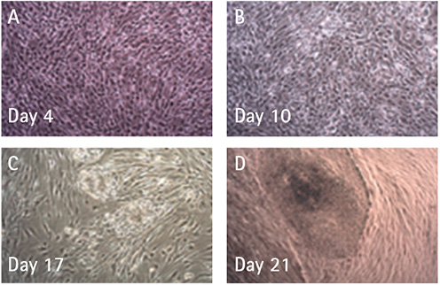 Brightfield microscopy shows HFFs being reprogrammed over a 21 day time period using a single transfection of Simplicon™ Reprogramming RNA. After 10 days of puromycin selection and replating on fresh PMEF cells, colonies started to emerge at day 17-21.