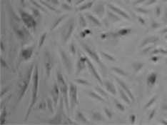  Cell growth after puromycin selection for four days - Infected with Virus