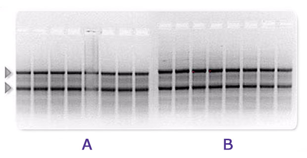 Comparison of two agarose electrophoresis gels of rRNA showing higher intensity bands in ultrapure vs pure water