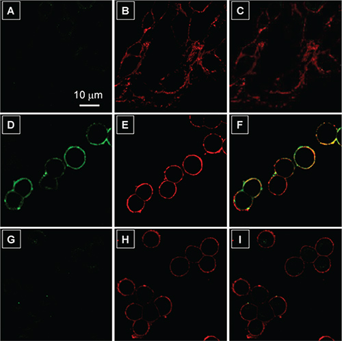 Confocal laser scanning microscopy (CLSM) images of live cells after incubation with 2 μM TPS-2cRGD in the absence and presence of a membrane tracker