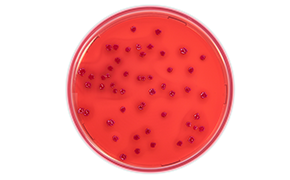 Escherichia Coli