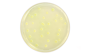 Pseudomonas Aeruginosa