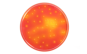 Staphylococcus Aureus