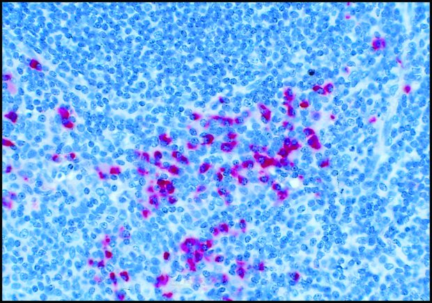 Formalin-fixed, paraffin-embedded section of human tonsil stained with Anti-Human IgG (gamma -chain specific)-Alkaline Phosphatase Conjugate, F(ab)2 fragment of goat antibody (Cat. No. A3312) using SIGMA FAST™ Fast Red TR/Naphthol AS-MX Tablets (Cat. No. F4523) as substrate.