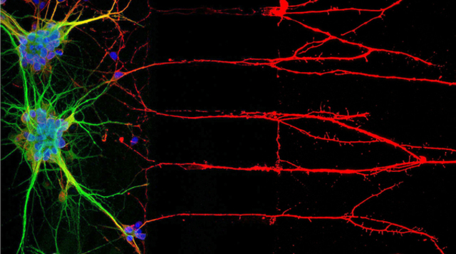 Immunocytochemistry (ICC) locates proteins associated with neuronal nuclei, soma, and axons