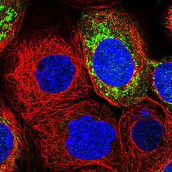 Anti-MRPS7 antibody stained in green showing single cell variation in A-431 cell line.