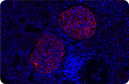 in situ PLA®的应用示例