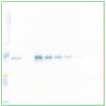 免疫印迹和免疫组织化学