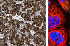 人-胰腺-组织-的-ihc-染色