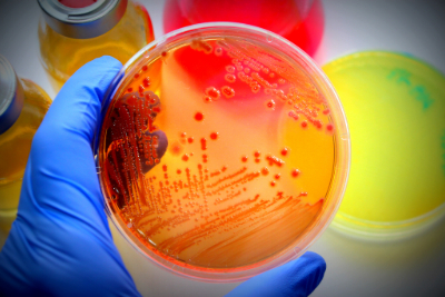A gloved hand holding a petri dish containing orange agar with visible bacterial growth, surrounded by colorful culture bottles in the background