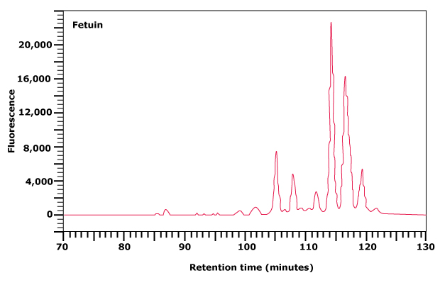 Normal phase HPLC profile of the 2‑AB labeled N-linked glycan library obtained from fetuin