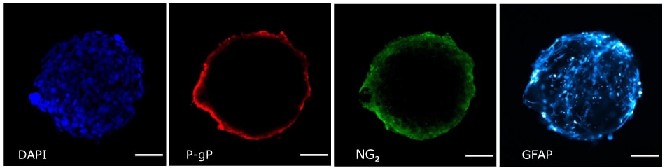BBB organoid layers Immunofluorescence imaging of BBB organoid layers.