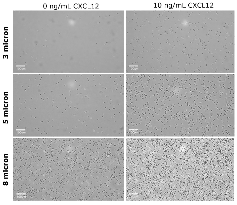 Cell migration of Primary CD4+ cells at different CXCL12 concentrations Microscopy images of cell migration of Primary CD4+ cells at different CXCL12 concentrations and insert pore sizes