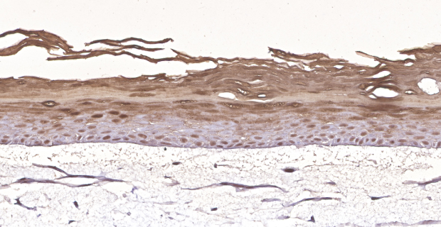 Organotypic skin models contain actively proliferating keratinocytes. (C)