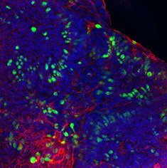 Mucin-2/F-Actin/DAPI