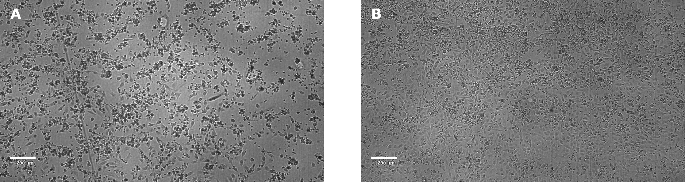 Microscopy of target cell killing in ADCC assay Target cell killing by NK effector cells in ADCC assay