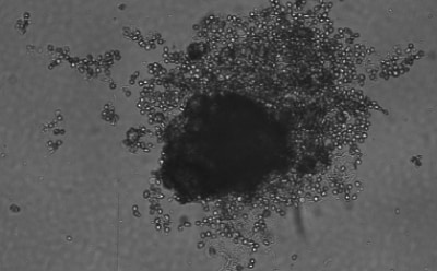 Spheroid-qualified Hepatocytes B Microscopy image of hepatocytes forming spheroids after 3 days. Dark grey rectangle with light grey dots at the top right indicating cells. Large black circle in the center of the image indicating a forming spheroid.