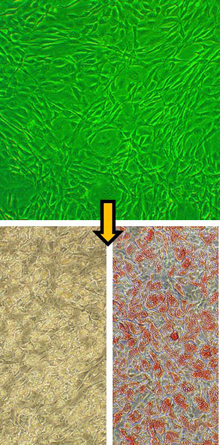 人前脂肪细胞(HPAd)