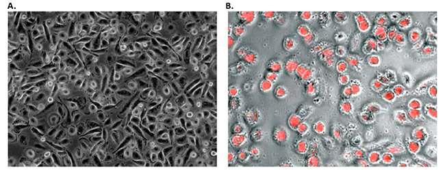 Morphology and phagocytic activity of human PBMC derived M1 macrophages.