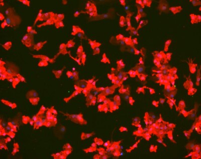 Microglia Immunofluorescent image of microglia