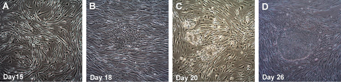 Time course of human iPSC colonies generation using Human Simplicon RNA Reprogramming Kit