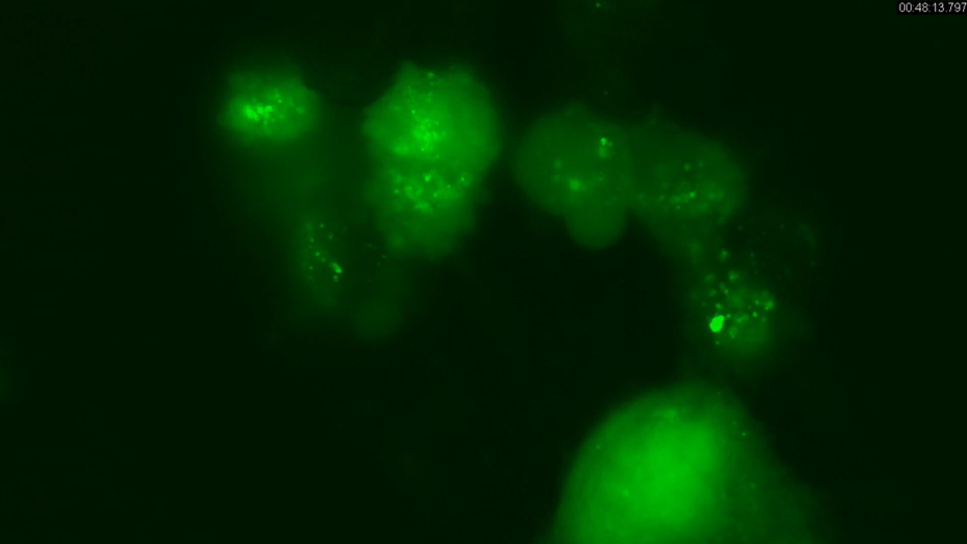 Live Cell Imaging of Autophagy using LentiBrite™ Fluorescent Biosensors Live Cell Imaging of Autophagy using LentiBrite™ Fluorescent Biosensors