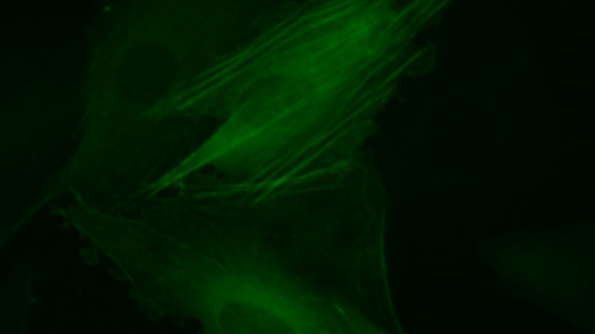 Live Cell Imaging of β-Actin Cytoskeleton Proteins using LentiBrite™ Fluorescent Biosensors Live Cell Imaging of β-Actin Cytoskeleton Proteins using LentiBrite™ Fluorescent Biosensors