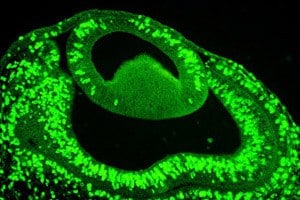 使用BrdU染色增殖E4鸡胚眼中的细胞
