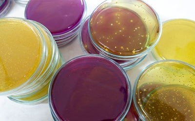 Bacterial cell culture on agar plates