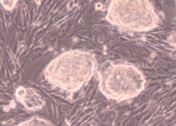 Mouse embryonic stem cells grown in the presence of feeder cells and 15% ES qualified FBS (ES-009-B) containing media after 4 days of culture.