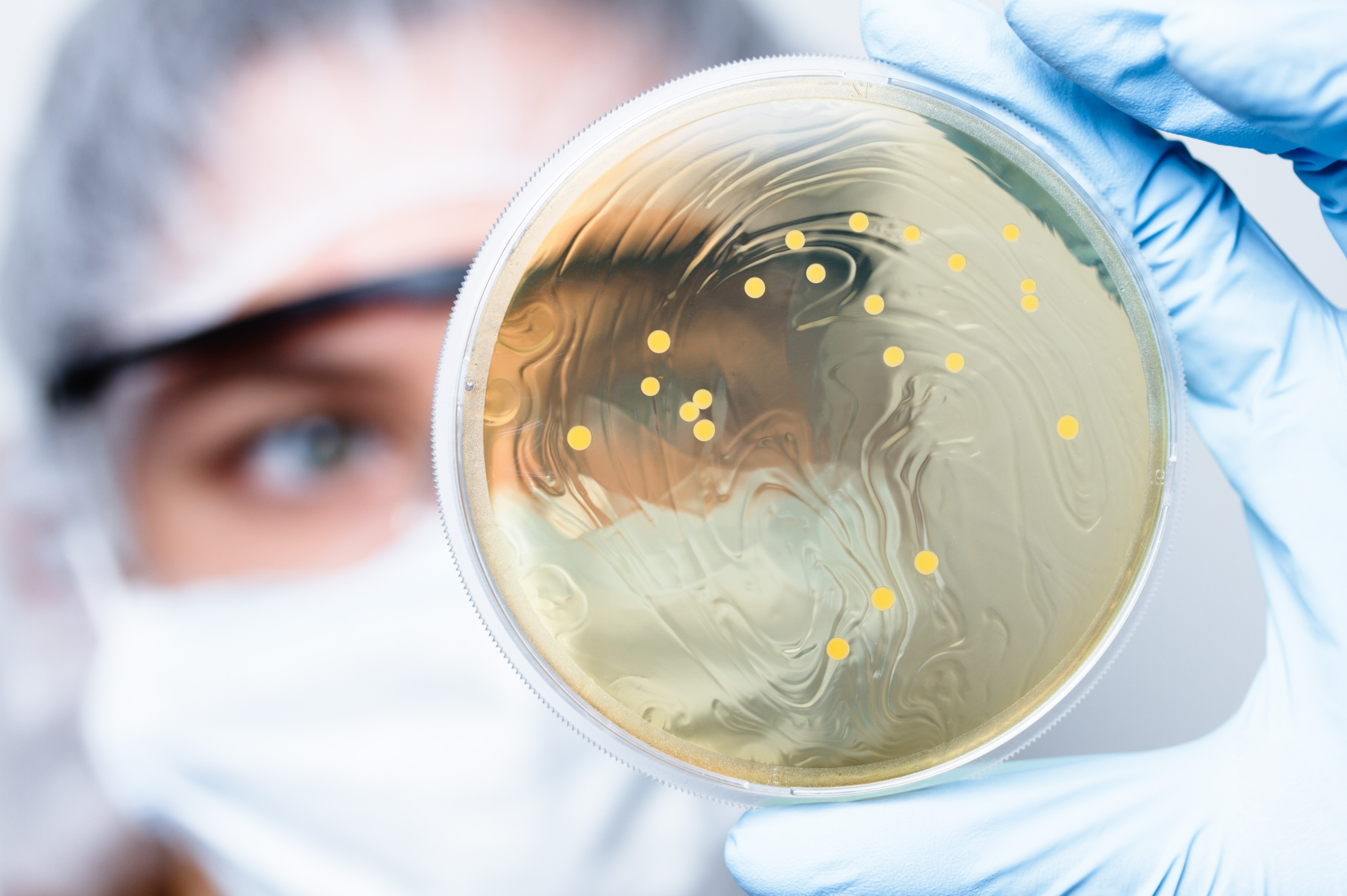 Scientist observing petri dish with bacterial colonies