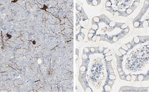 Enhanced Validation Antibodies