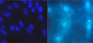 DAPI或Hoechst等常见DNA检测试剂结合荧光显微镜揭示污染培养物中存在的支原体。