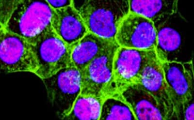 Fluorescent staining of cultured mammalian cells