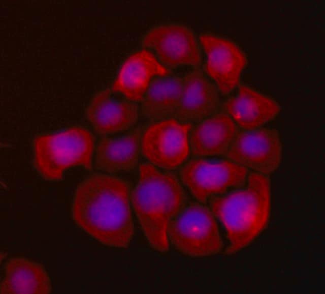 Fluorescent staining of UFH-001 Human Breast Cancer Cells