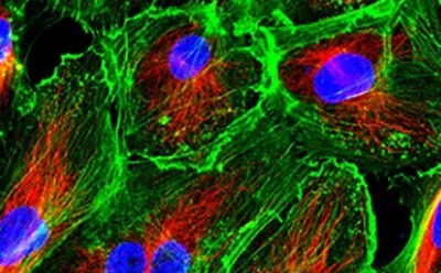Fluorescent image of human primary epithelial cells in culture