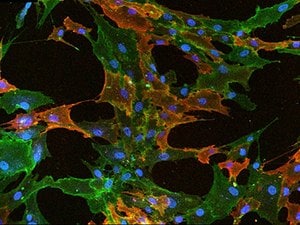 Fluorescent ICC staining of mesenchymal stem cells