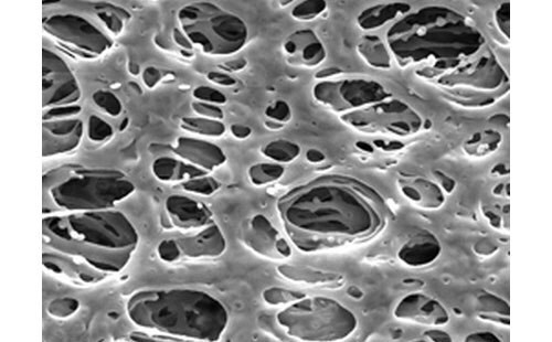 Scanning electron microscope (SEM) image of polyethersulfone (PES) membrane filters